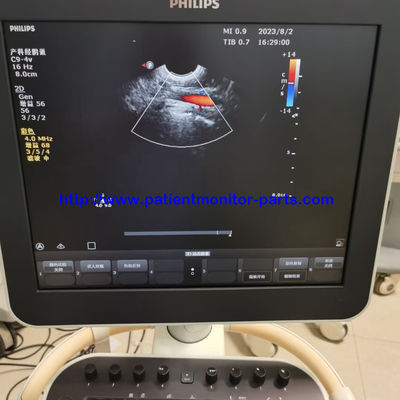 Συστήματα διάγνωσης υπερήχων σειράς Φίλιπ CV